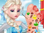 Elsa Foot Doctor Game