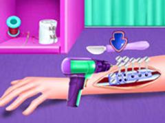 Elsa Fracture Surgery