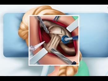 Jogos de Cirurgia de Frozen para Crianças - Ella Hip Surgery 