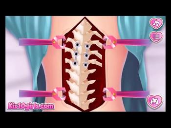 Anna Scoliosis Surgery - Game Walkthrough  Kiz10girls.com 