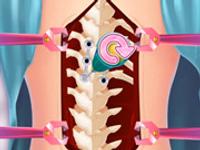 Anna Scoliosis Surgery